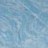 Blue Swirl Thumb